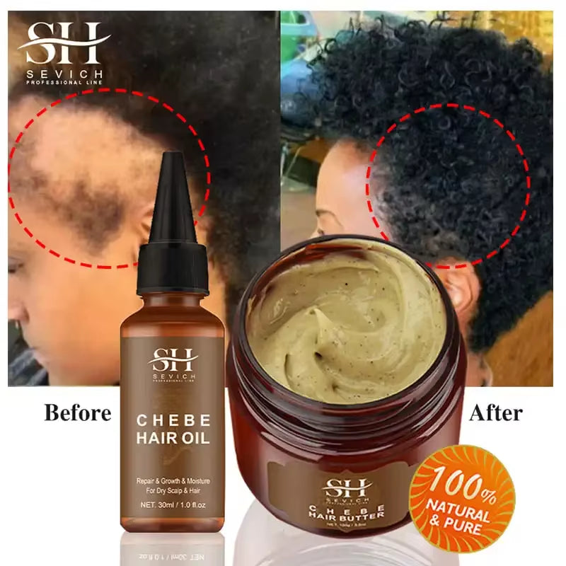 Crazy Fast Hair Growth Product 30Ml Africa Traction Alopecia Chebe Oil anti Hair Loss Treatment for Man Women Hair Care